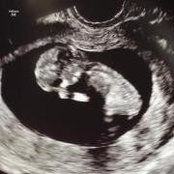 Tashina Defibaugh's photo