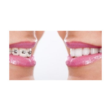 Cosmetic Dentist Beaumont, TX - Joel Lane Smith, DDS (409) 895-0089