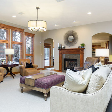 From Traditional to Transitional Facelift