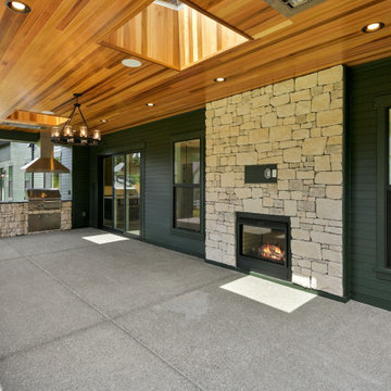 Parthenon | Bellevue