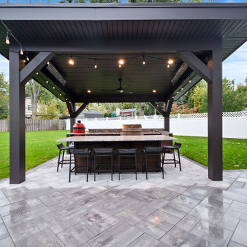 Custom Pergola
