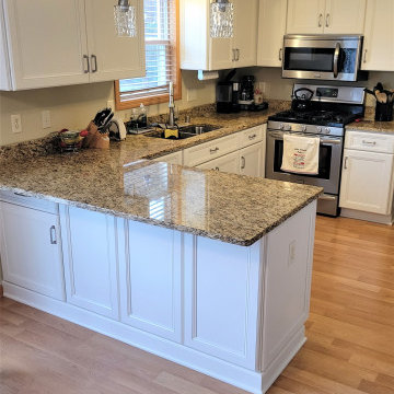 Refacing