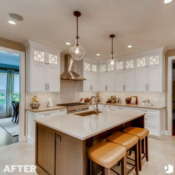 Serial Remodeler