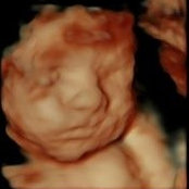 Cameron Millirens billede