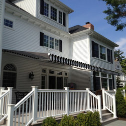Striped Awnings by Breslow - Awnings