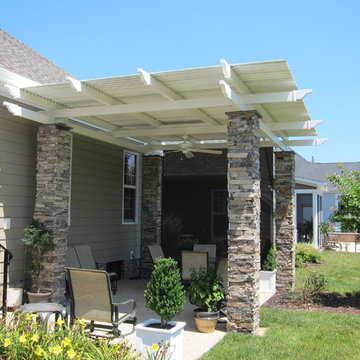 American Louvered Roof 1