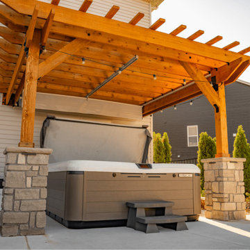 Pergola Hot Tub