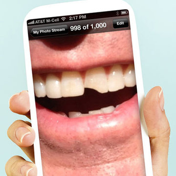 Jim Carrey’s Bonded Tooth | DentalPlans Blog
