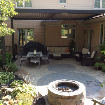 Arcadia Louvered Roof: variety of installation types