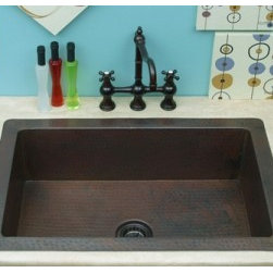 Windsor Drop-in Hand Hammered Copper Sink - Brackets