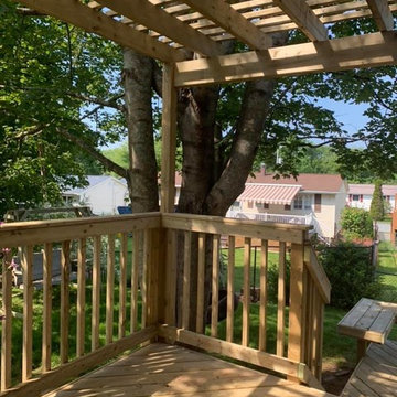 Dartmouth Two-level Deck With Pergola