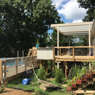 ShadeWorks Louvered Pergola Installs