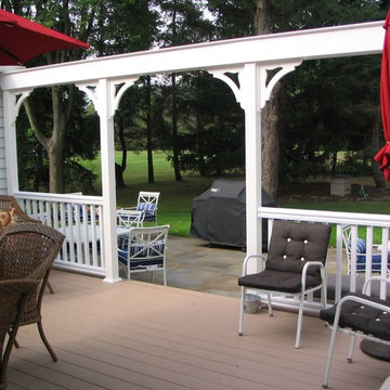 Porch brackets