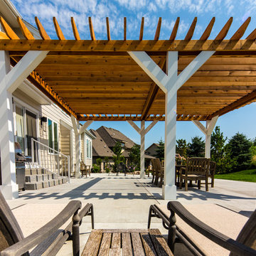 West Des Moines Custom Pergola
