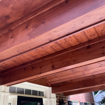 Gable Roof Porticos