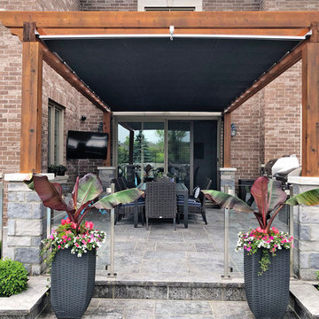 Retractable Shade, King City