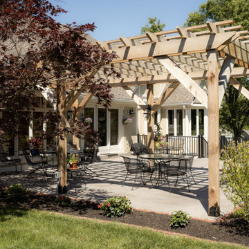 Large Split-Level Patio + Pergola