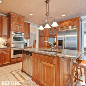Serial Remodeler