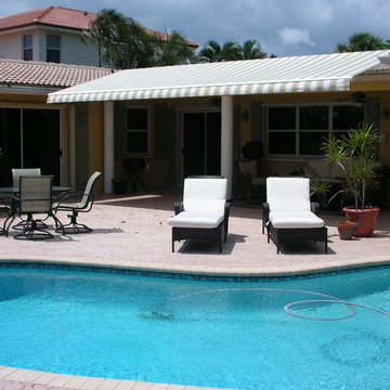 Retractable Awnings from Sunesta