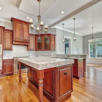 Madison Estates II: Lot 2 - 15W780 87th Street, Burr Ridge