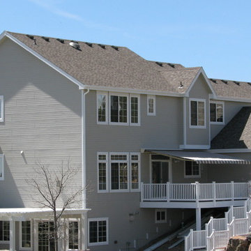 Retractable Awning - Littleton