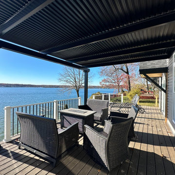 Operable Pergola