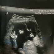 Jordyn Setzer's photo