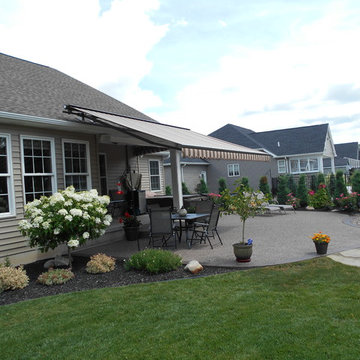 Retractable Awning