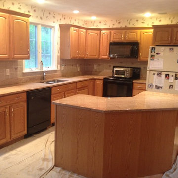 Before refacing
