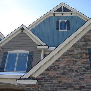 Siding (LP Smart Side & Hardie Siding)