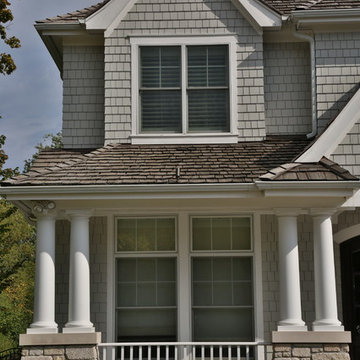 Home Exterior Project - Deerfield IL