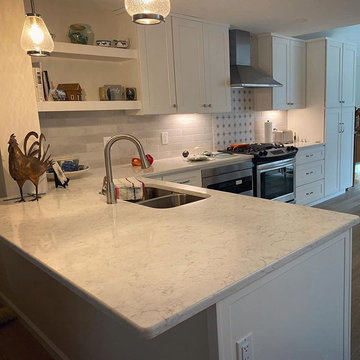 Advanced Remodeling