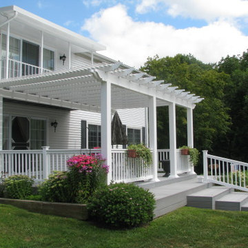 Pergolas