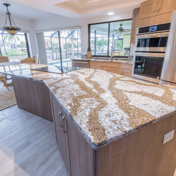 Skyline Remodel