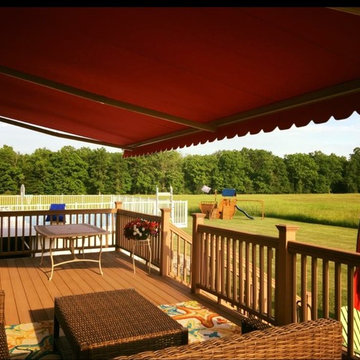 Motorized Retractable Awning