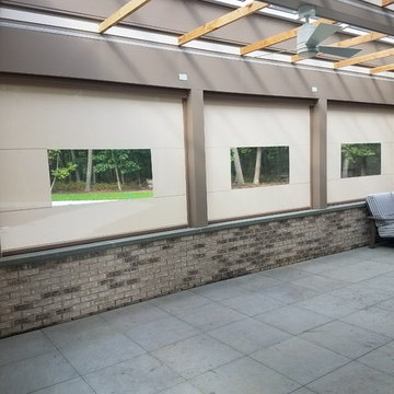 Retractable Flex screens