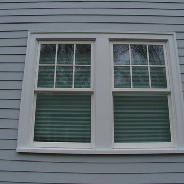 Exterior Facelift