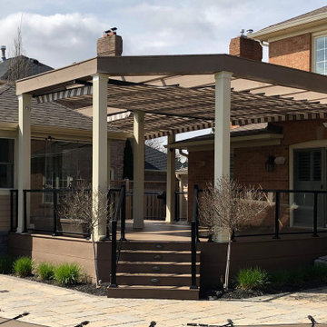 Retractable Canopies, Burlington