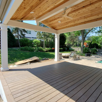 Big Time Backyard