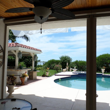 Zip Tex Retractable Screens