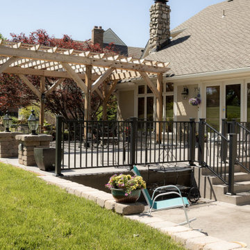 Large Split-Level Patio + Pergola