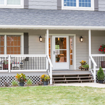 White Retractable Screen Away Storm Door