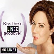 NO Linezs billede