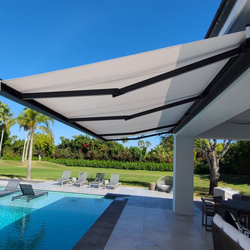 Luxury Retractable Awning