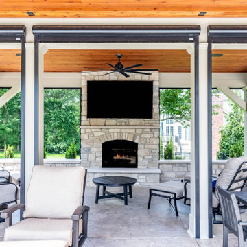 Covered Patio with a Hip Style Roof