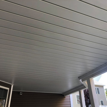 Under Deck Ceiling Systems