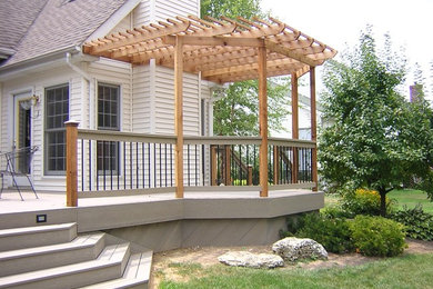 Azek, Timbertech, and Wood Decks (Contact us to show you samples in person)