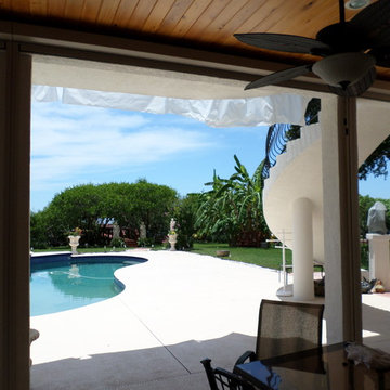 Zip Tex Retractable Screens