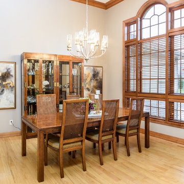 From Traditional to Transitional Facelift