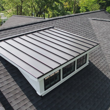 Exterior Project Completed - Glenview IL